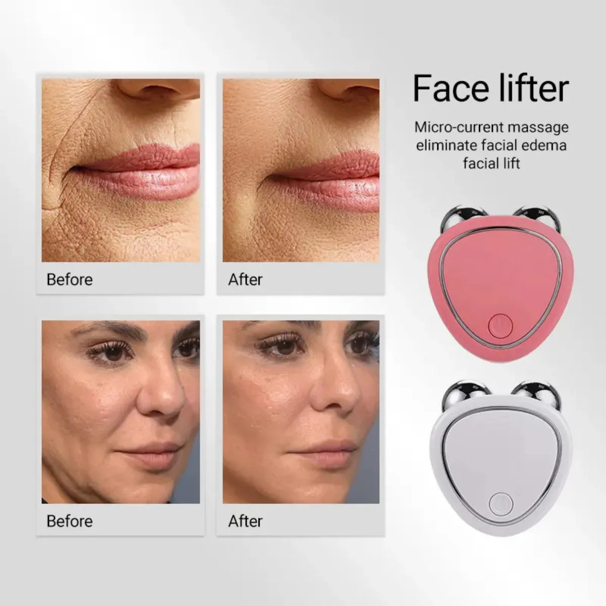 Masajeador Facial Microcorriente Premium Rosa Y Blanco