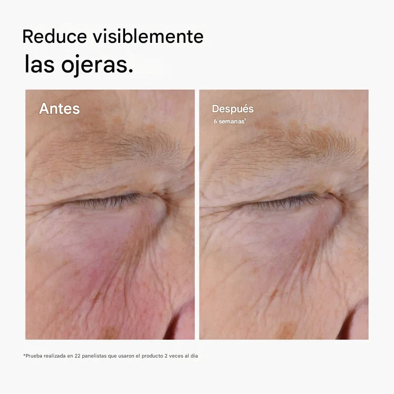 The Ordinary - Caffeine Solution 5% + Egcg
