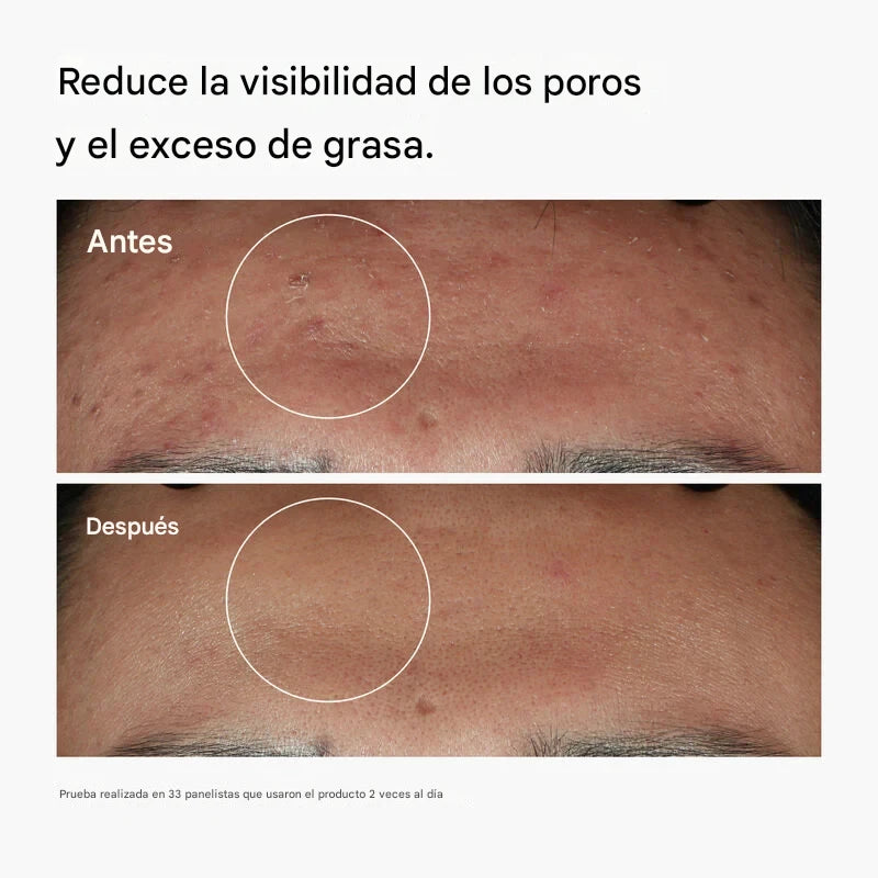 The Ordinary - Niacinamide 10% + Zinc 1%